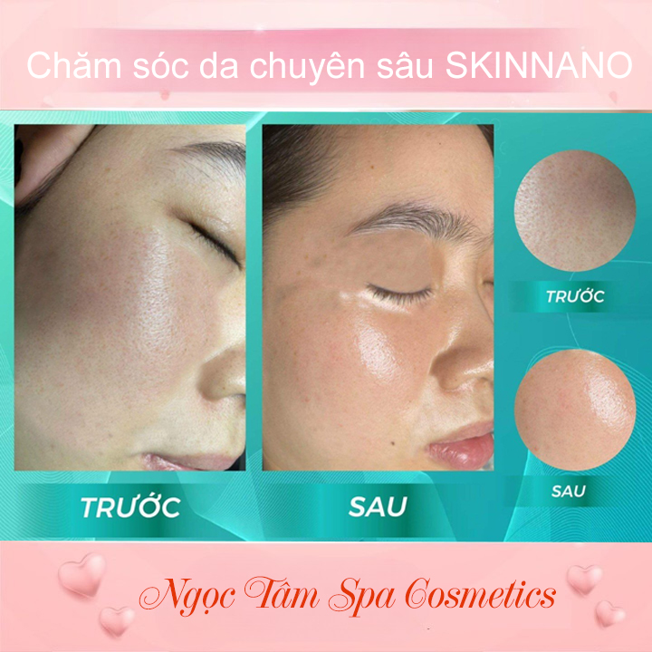 Chăm-sóc-da-chuyên-sâu-SKINNANO