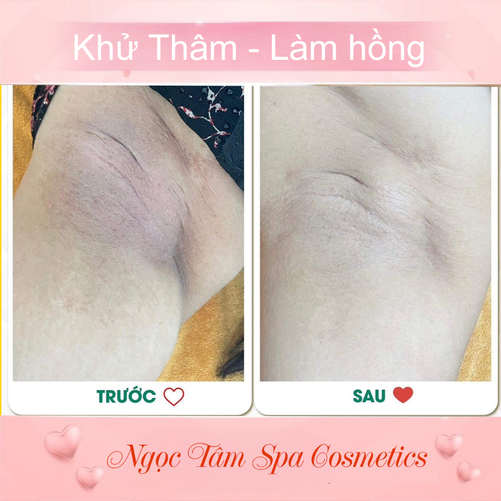 Khử-Thâm-Làm-hồng